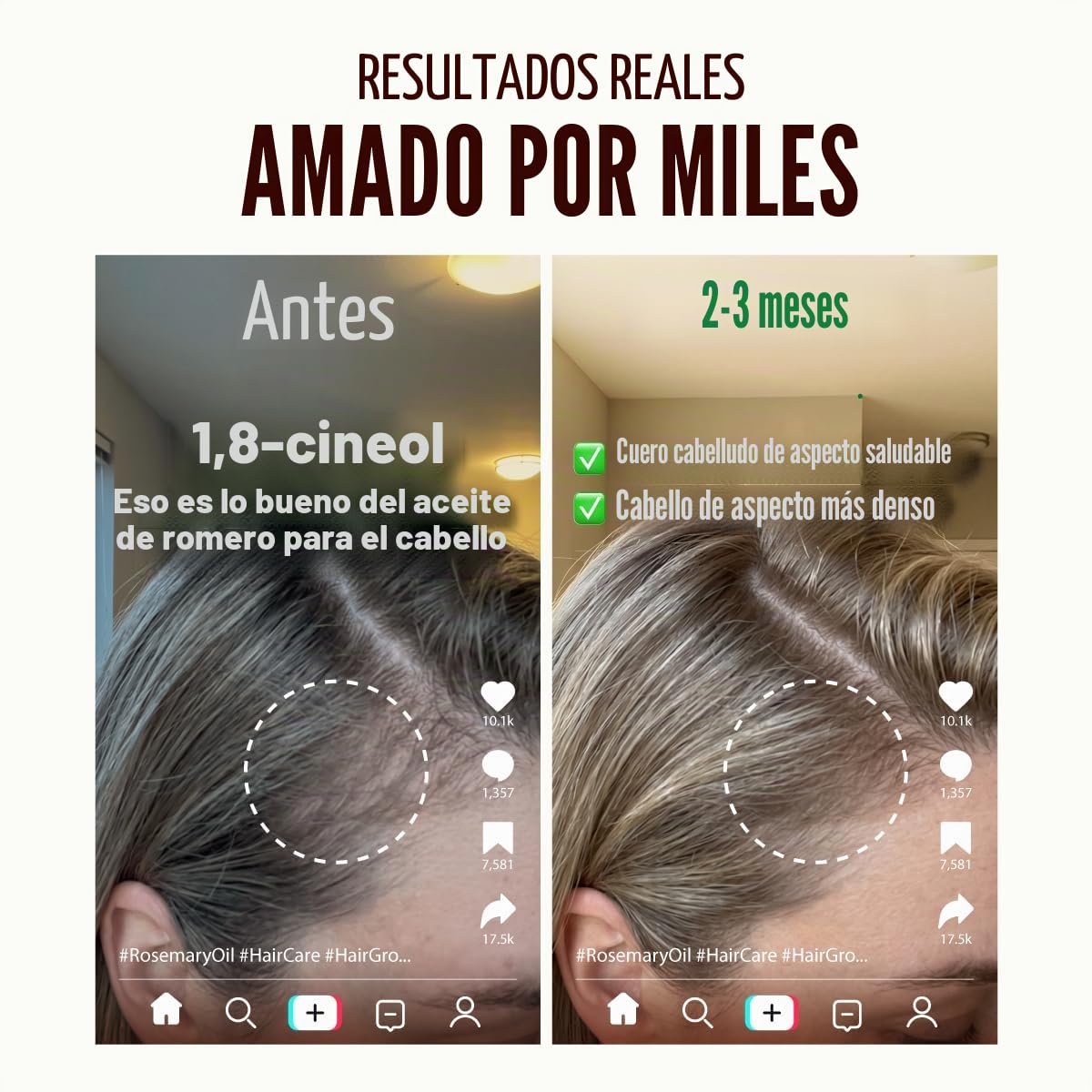 Kukka Aceite romero para el crecimiento cabello (118 ml) - Aceites romero 100% naturales sin diluir para piel, difusor, cuero cabelludo seco y aromaterapia - Aceite romero para el crecimiento cabello