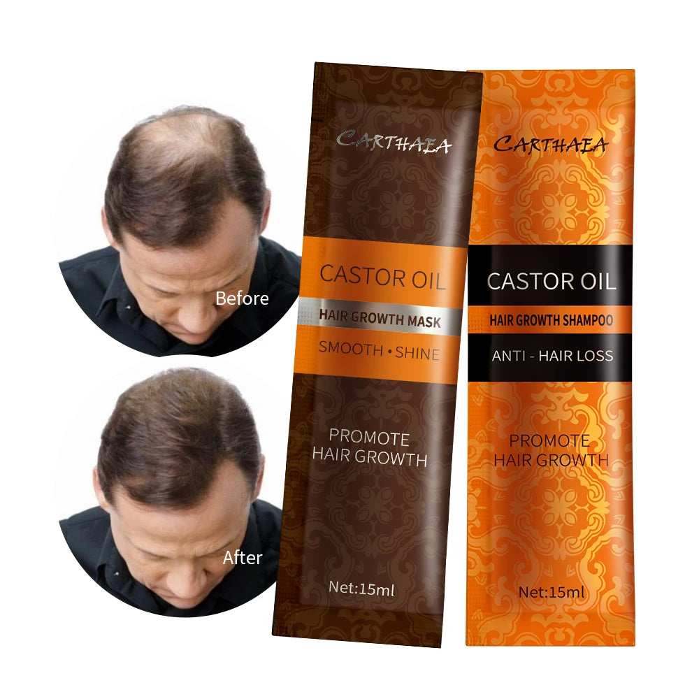 New Products Hair Treatment Castor Oil Shampoo and Conditioner Hair Growth Hair Growth Shampoo