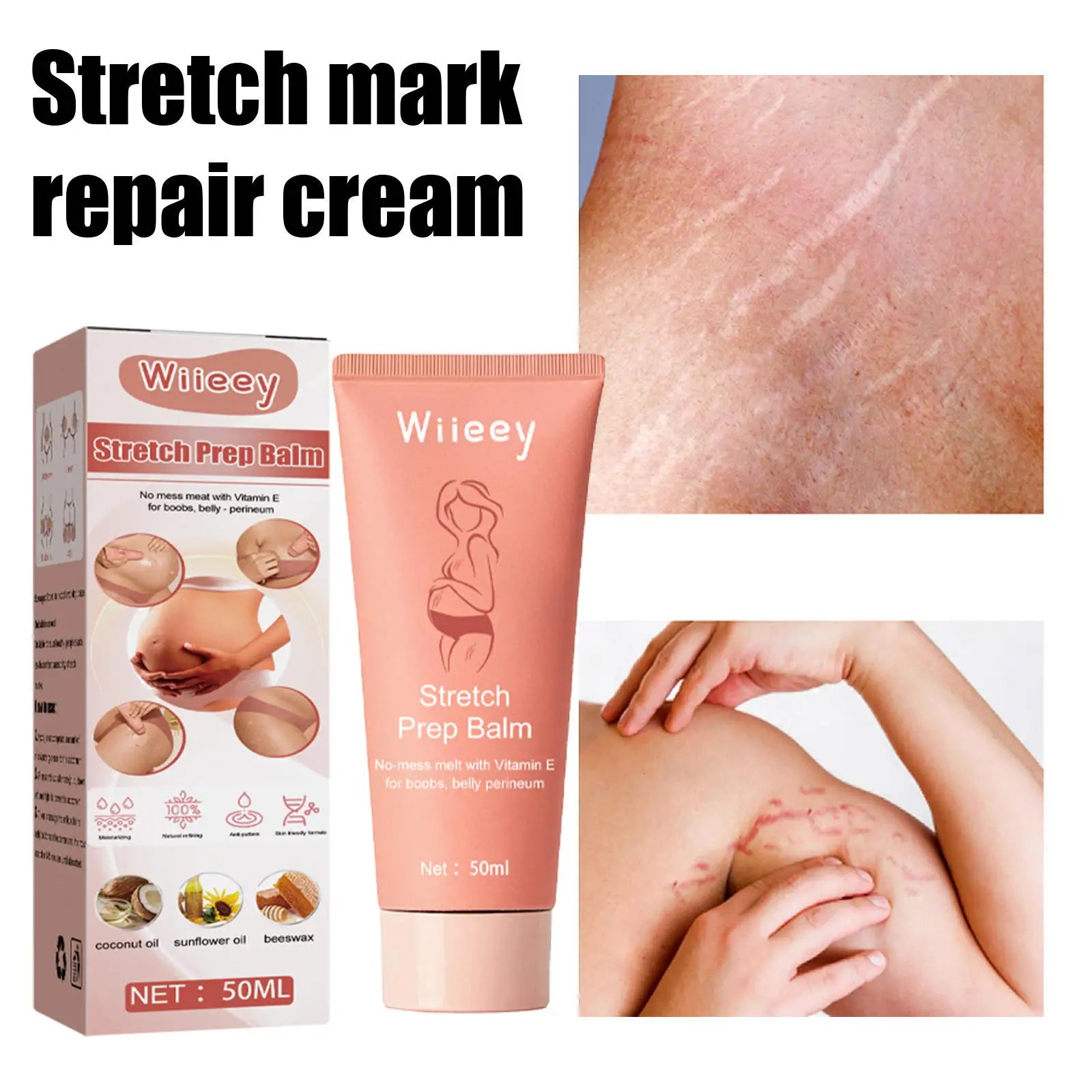 2025 Hot Sales Postpartum Body Care Repair Firming Stretch Marks Cream Vegan Stretch Marks Removal Cream 50ml Volume