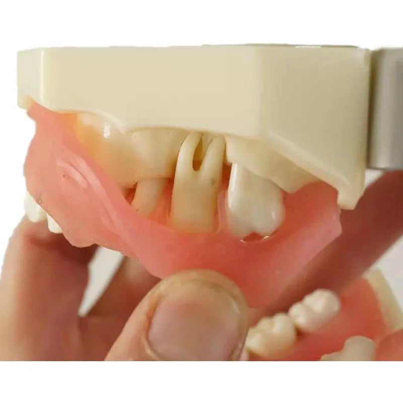 Medical Science Teaching Oral Dental Student Study Model Gingival Disease Model