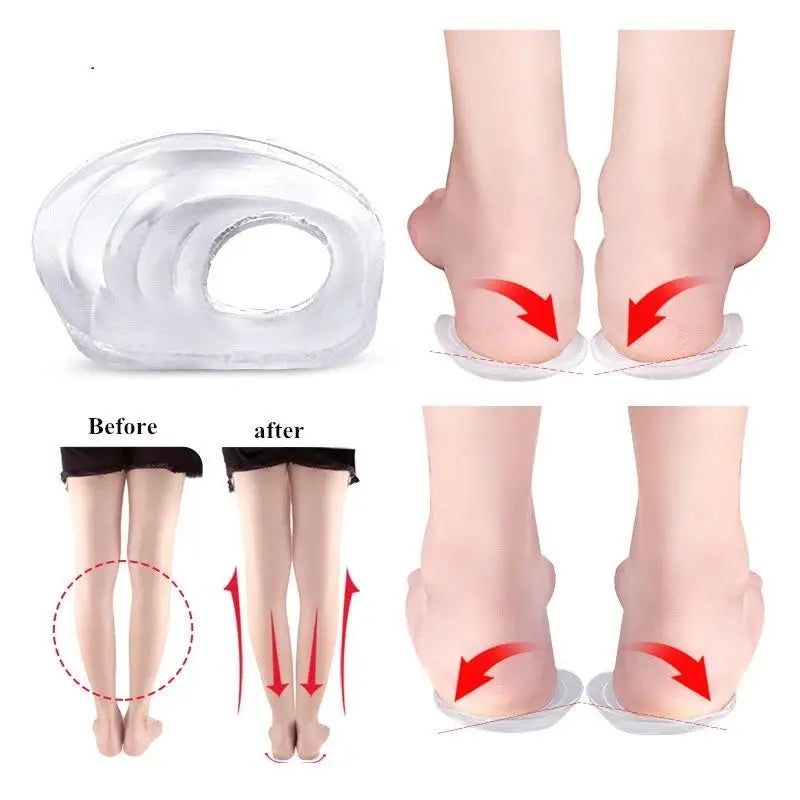 New Orthopedic Silicone Heel Pad Insoles O/X Type Legs Correction with PU Transparent Gel Comfort Shoe Cushions