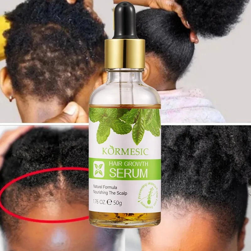 KORMESIC Private Label Argan Oil Natural Organic Serum Hair Growth Oil for Men and Women Hair Growth