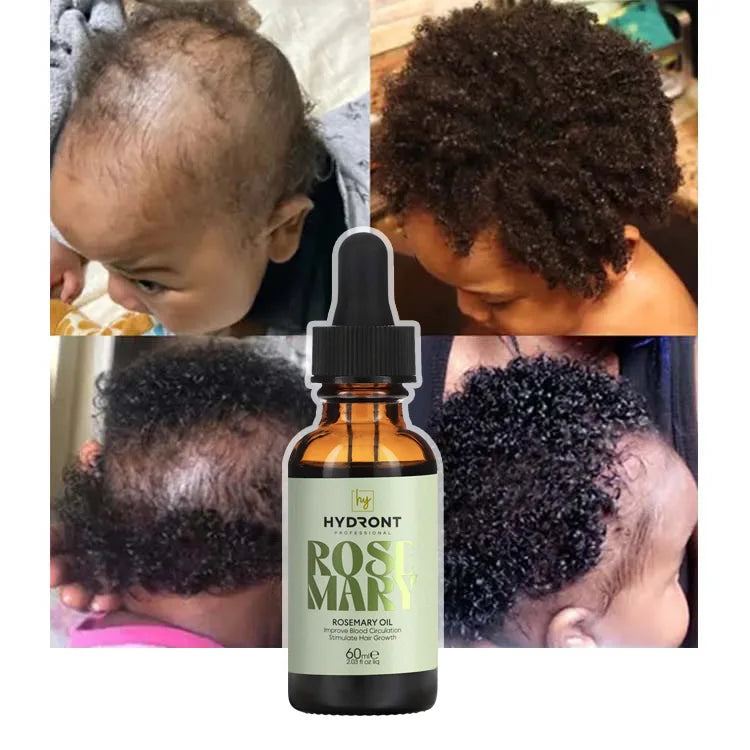 OEM ODM Natural Organic Vegan Rosemary Hair Growth Oil Fast Acting Hair Serum for Black Women for Home Use