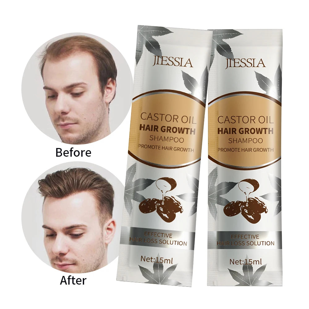 Private Label  Anti Hair Loss Shampoo 350ML Hair Care Castor Oil Fast Hair Growth Shampoo