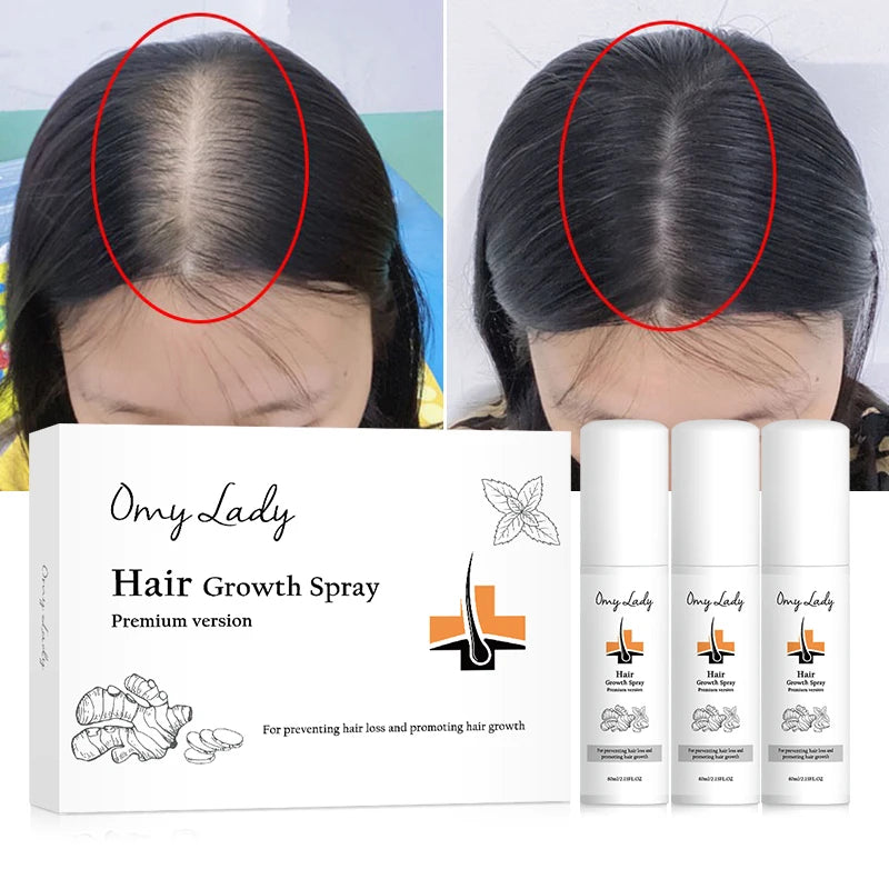 New Sample Fast Effective 7 Days Growth Hair Serum Treatment Keratin to Stop Hair Fall
