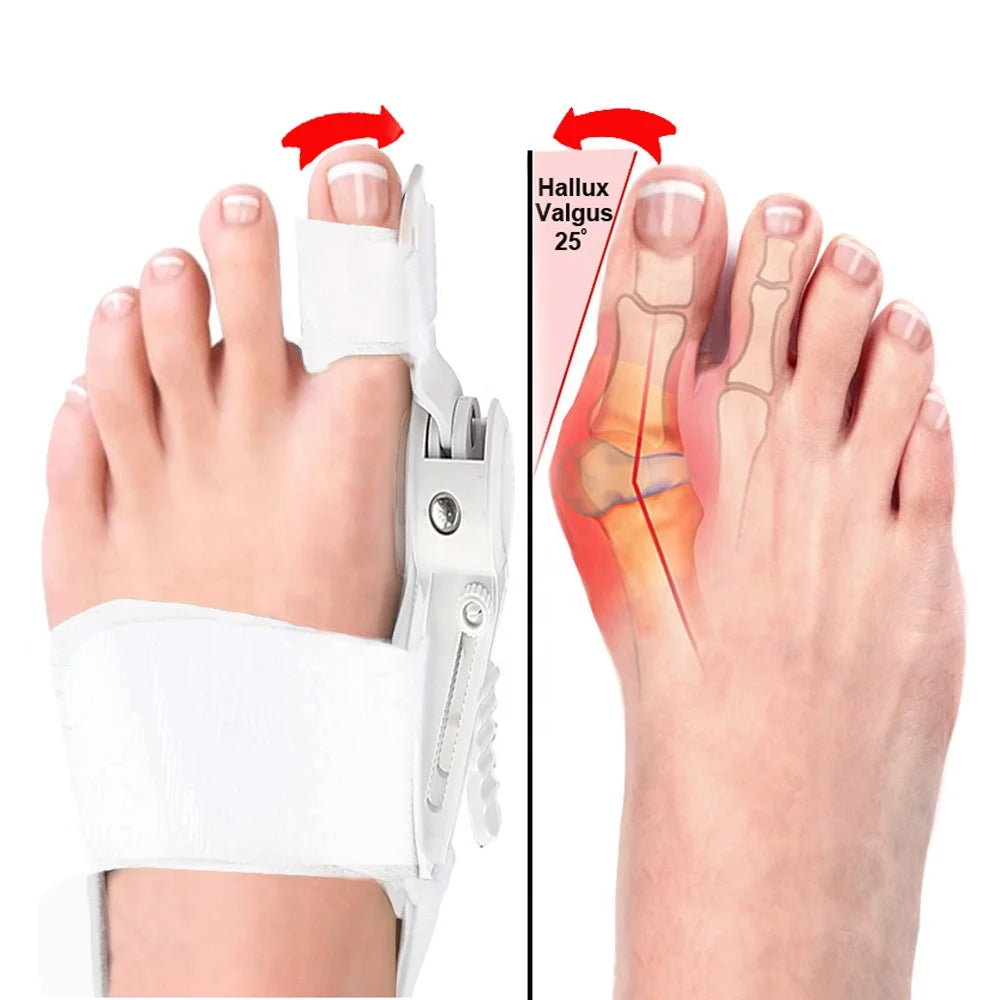 MediFootCare Toe Separator Splint Hallux Valgus Orthopedic Adjustable Braces Big Toe Straightener Bunion Corrector HA02068