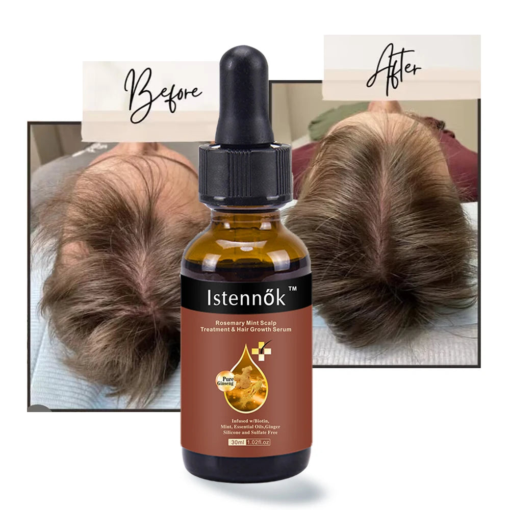 Organic Biotin Ginger Castor Oil Hyaluronic Acid Leave-In Hair Growth Oil for Women's Hair Loss Treatment Dry/Damaged Hair