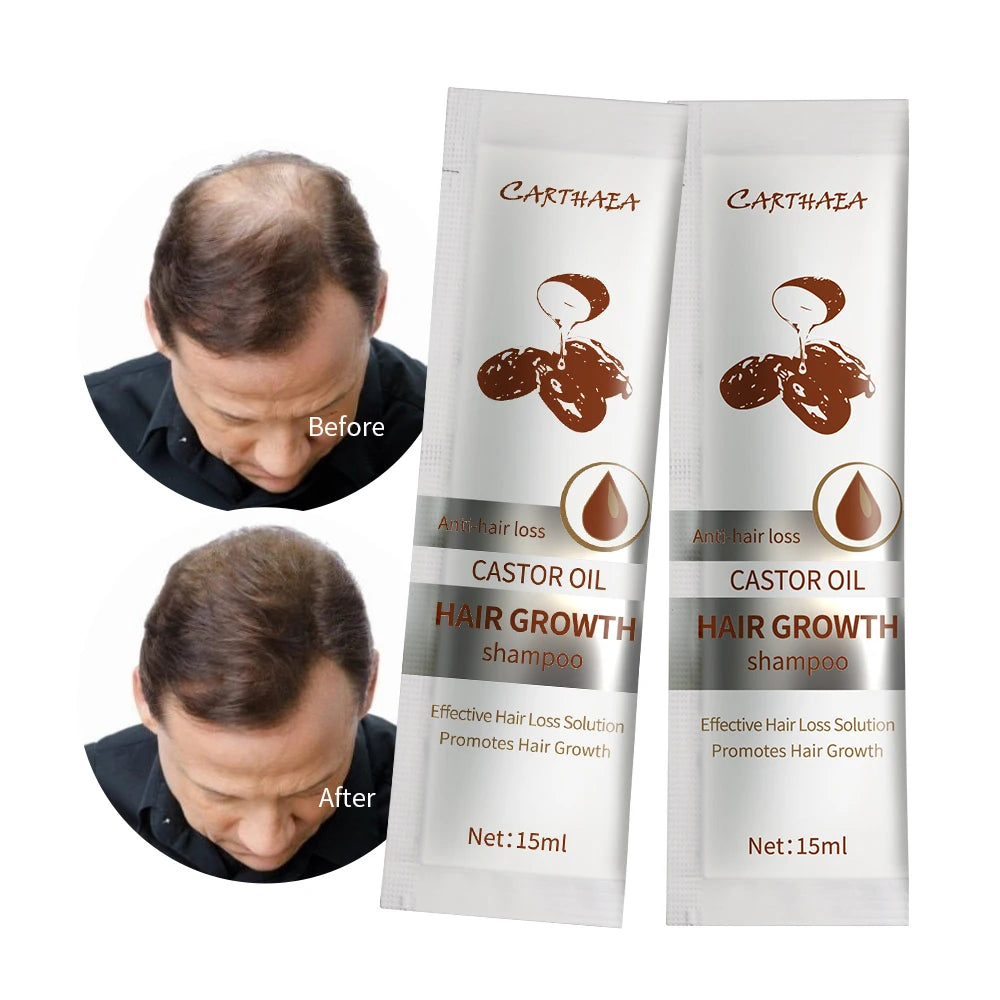 Private Label Castor Oil Treatment Shampoo Hair Loss Strengthen Hair Roots Fast Hair Growth Shampoo