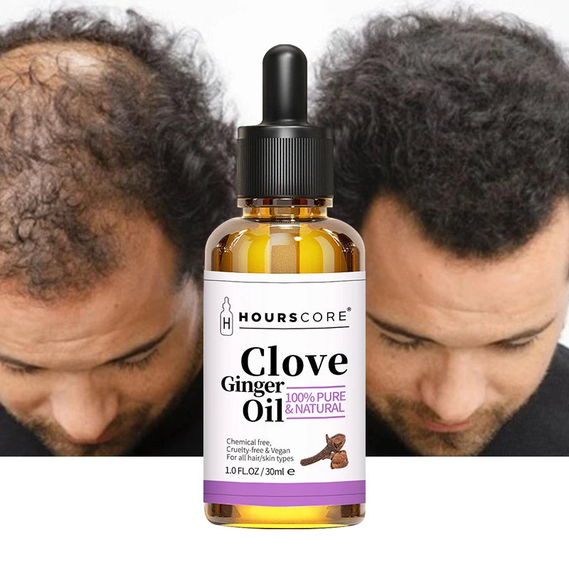 Private Label 100% Natural Ingredients Extract Hair Care Loss Treatment Hair Growth Clove Oil Serum