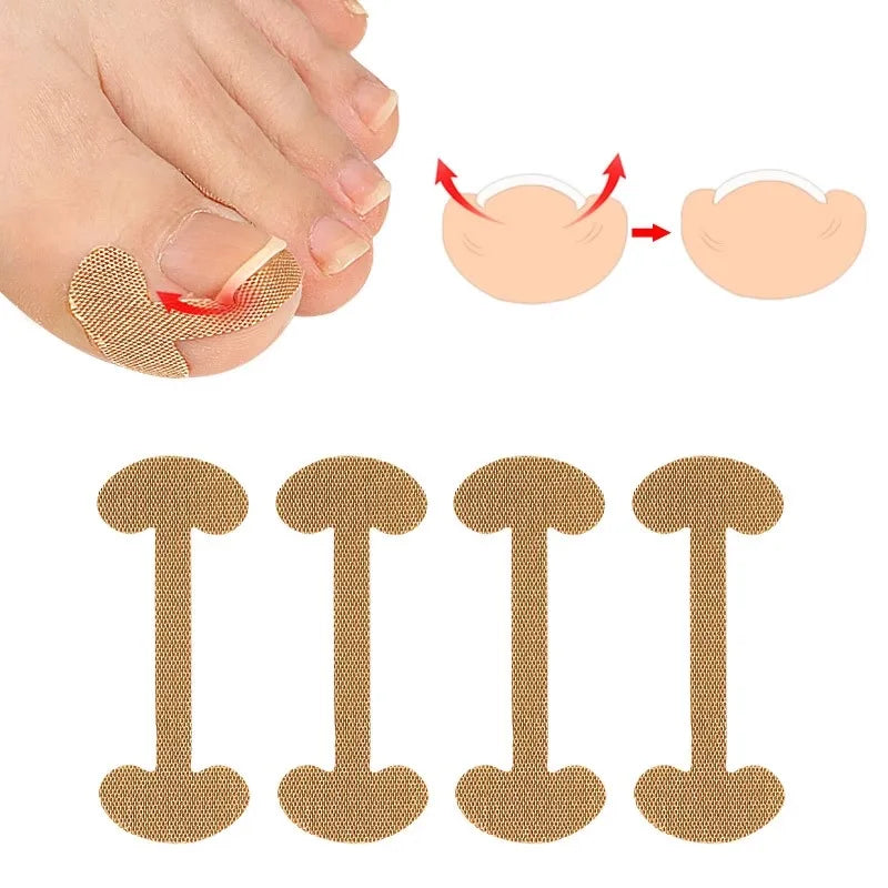 4 PCS Comfortable Soft Waterproof High Elasticity Cotton Single Sided Toenail Ingrown Corrector Patches Stickers Pedicure Too