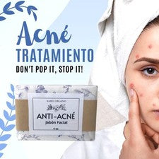 JABON FACIAL ANTI-ACNÉ ELIMINA GRASA, ESPINILLAS,GRANOS, PUS Y ENROJECIMIENTO!