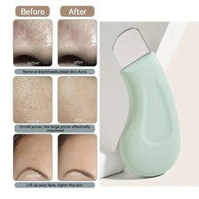 Herramienta removedora de espinillas para nariz facial limpiador de poros cuidado de la piel para mujeres