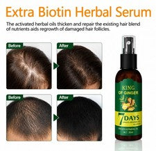 Spray para el crecimiento del cabello de jengibre cuidado de raíces a base de hierbas cuero cabelludo suero nutritivo 30