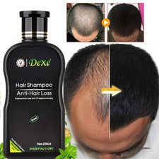 Champú de crecimiento rápido del cabello para mujeres hombres tratamiento anti pérdida de cabello cuidado engrosamiento