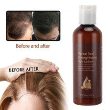 Loción para el cuidado del crecimiento del cabello efecto hidratante 3 piezas 100 ml fortalecimiento de la raíz del cabe