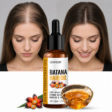 Aceite capilar Batana para el crecimiento del cabello hombres mujeres puro natural anti pérdida de cabello 50 ml