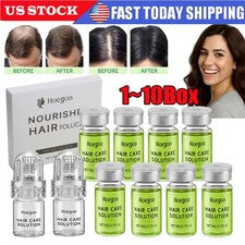 Sistema avanzado de regeneración del cuero cabelludo con microagujas Alpha Infuse tratamiento de pérdida de cabello EE. 