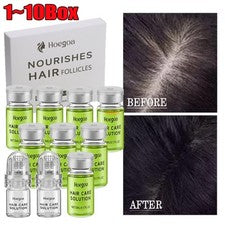 Tratamiento avanzado de regeneración del cuero cabelludo con microagujas Alpha Infuse para adelgazamiento del cabello