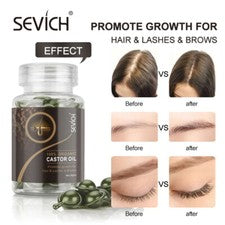 Aceite acondicionador para el crecimiento del cabello reparación de vitaminas cuidado del cuero cabelludo del cabello se