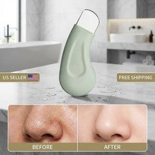 Herramienta de eliminación de espinillas y espinillas - Extractor de acné raspador facial para el cuidado de la piel