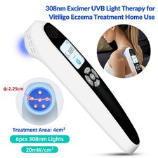 Home Use UVBLight 308nm Dispositivo de terapia de luz para el cuidado de la piel Fototerapia 6 diodos