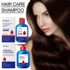 Champú para el cuidado del cuero cabelludo 120 ml, minimiza la pérdida de cabello del cuero cabelludo, mejora el cabello