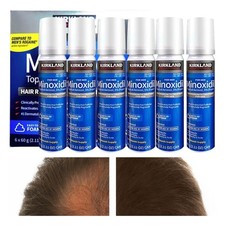 Aceite para el cuidado del cabello 6X aceite para el cuidado del cuero cabelludo cuidado personal no graso acondicionado
