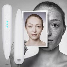 Skin Tag Remover Pen Spot Mole Scanning Mini cuidado facial para