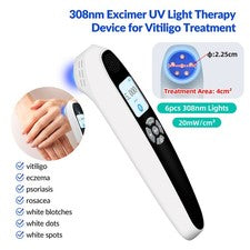 Dispositivo de terapia de luz excímero UVB de 308 nm cuidado de la piel dispositivo de mano portátil ligero