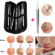 Pinza extractora de comedones de manchas espinillas removedor de espinillas removedor de espinillas para acné herramient