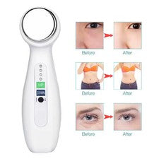 Limpiador facial eléctrico 1Mhz 3Mhz 7 colores levantamiento de fotones masajeador facial