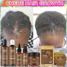 Set Crecimiento Cabello Aceite Chebe Anti Rotura Pérdida Nuevo África Tratamiento Cuidado Esencia