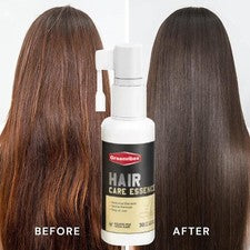 Spray esencial para el cuidado del cabello Graanvibes para cabello nutritivo del cuero cabelludo anti-frescante y O0T5