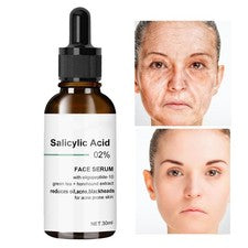 Lifting facial de caresero ácido salicílico reafirmante reductor líneas finas nutritivo
