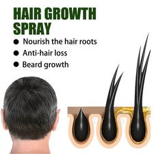 4x 50 ml Cuidado del Crecimiento del Cabello Spray Folículo Cabello Suero Hidratante Nutritivo F NUEVO