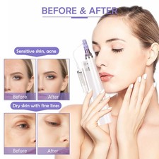Venta caliente Herramienta hidratante Plumas Dispositivo de hidratación facial Equipo de cuidado de la piel facial