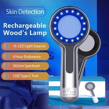 Lámpara de madera para analizador de piel de vitiligo detector de hongos facial musgo tiña analizador