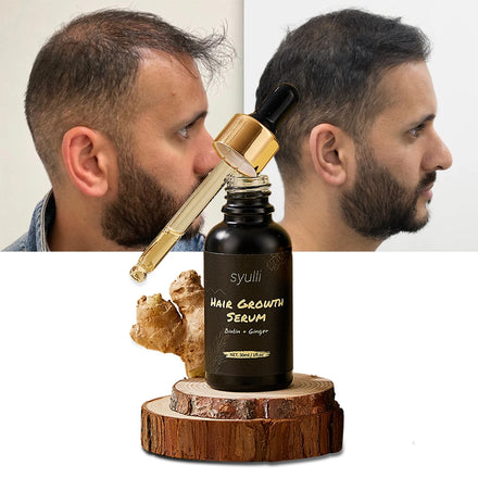 Organic Ginger Hair Growth Serum Follicle Boost Density Improvement Scalp Treatment Moisturizing Anti-Dandruff Benefits