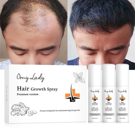 Best Seller OMY LADY Sample Hair Serum Brand 100% Natural Anti Dandruff Loss Hair Treatment