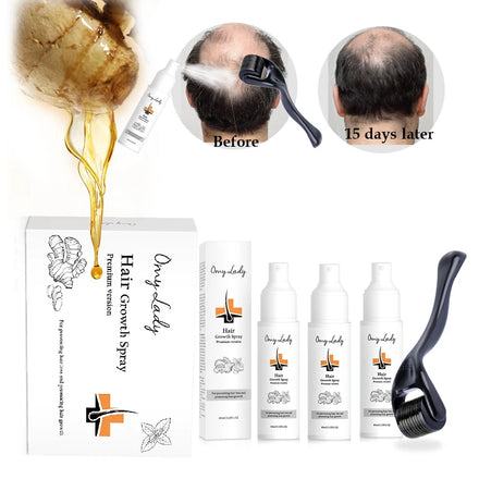 Men's Hair Care Product Organic Ginger Hair Growth Sample Nutrient Solution Hair Loss Treatment for Bald
