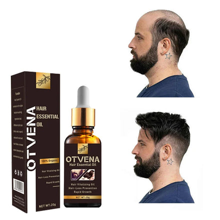 OTVENA Top Selling Strong Healthy Hair Treatment Scalp OEM/ODM Regrowth Oil Hair Care for Men Hair Growth Oil Serum