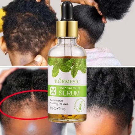 KORMESIC Private Label Argan Oil Natural Organic Serum Hair Growth Oil for Men and Women Hair Growth