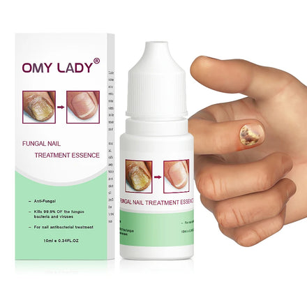 Manufacturer Wholesale Custom LOGO Finger Repair Treatment Solution Fungus Nail Treatment Repair Gel