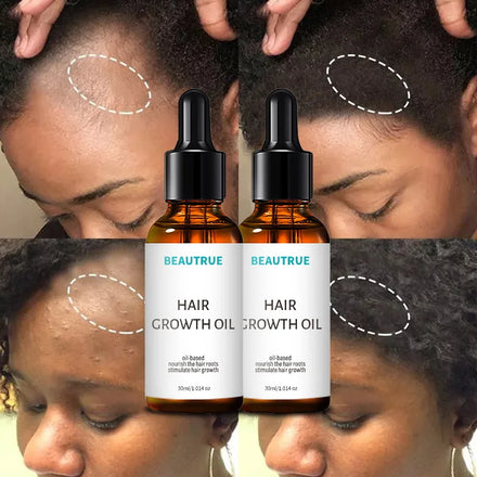 MSDS Factory Private Label Best Hair Growth Oil for Baldness Scalp Repair Hair Oil Anti Loss Hair Growth Oil