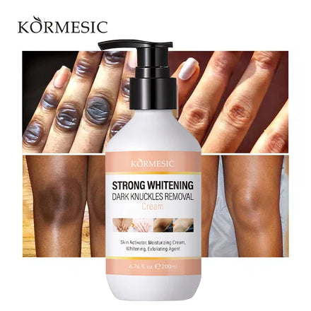 OEM KORMESIC Private Label Dark Knuckles Whitening Serum Lighten Finger Removing Dark Elbow Knee Finger Joint Whitening Cream