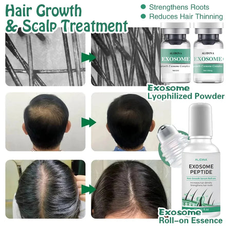 ZS Topical Hair & Scalp Regeneration Kit Biotin Hair Growth Roll-on Serum Freeze-dried Plant-exo EGF Anti-Hair Loss Treatment