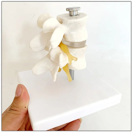 Detachable 2 Vertebrae Human Lumbar Disc Herniation Model Vertebrae Spinal Column for Chiropractors