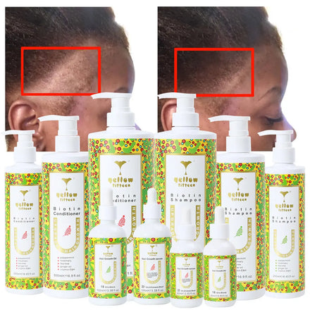 Custom Logo Hair Loss Hair Care Products Rosemary Hair Growth Shampoo