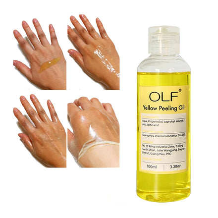 Private Label Extra Strength Whitening Acanthosis Nigricans Dark Knuckles Body Skin Orange Extra Strong Yellow Peeling Oil